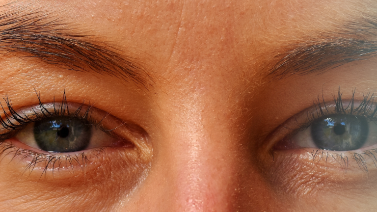 How to Fix a Lazy Eye: Tips for Successful Treatment